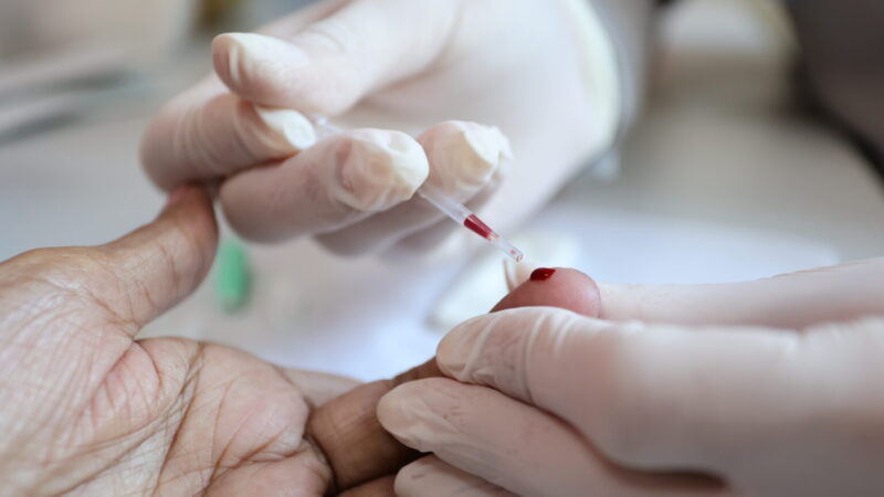 Prefeitura reforça ações de prevenção e diagnóstico das hepatites virais