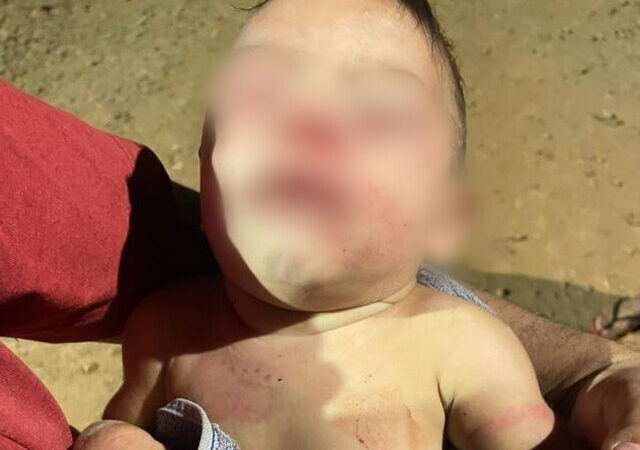 Mãe sai para trabalhar e pai espanca bebê de apenas 4 meses na Capital