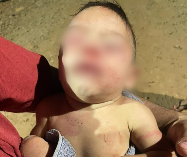 Mãe sai para trabalhar e pai espanca bebê de apenas 4 meses na Capital