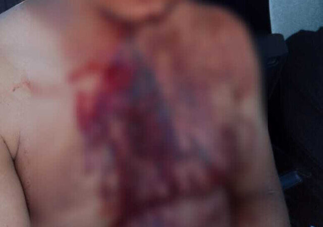 Serralheiro tem pescoço cortado após ter casa invadida e ser rendido por ladrões