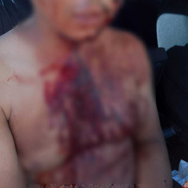 Serralheiro tem pescoço cortado após ter casa invadida e ser rendido por ladrões