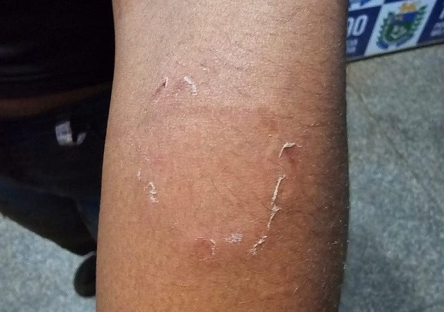Após várias ligações, polícia prende homem que enforcou e mordeu mulher