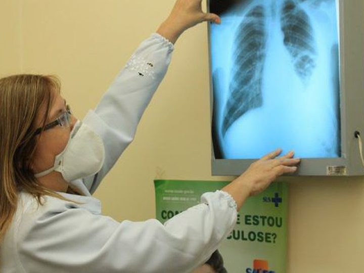 Prefeitura capacita equipes de saúde após aumento de casos de tuberculose em Dourados